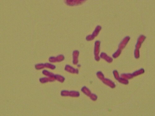 Shallot: Feulgen stained chromosomes of Allium ascalonicum examined under microscope