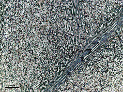 Poison hemlock: Conium maculatum Hemlock LEAF epidermis print