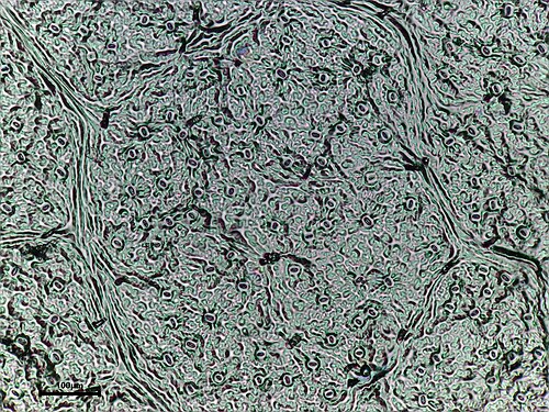 European beech: Beech Fen Rd hedge Fagus sylvatica LEAF epidermis print