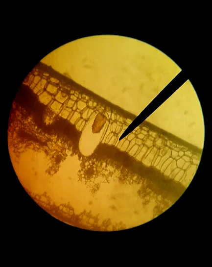 Rubber plant: This photography represents cystolith in epidermal cells of Ficus Elastica. Cystolith is a botanical term for the inorganic concretions, usually of calcium carb
