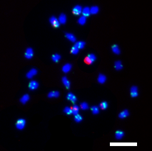 Sickle medick: Karyotype of tetraploid Alfalfa (Medicago sativa ssp. falcata). 2n=4x=36. Scale bar = 10 μm.