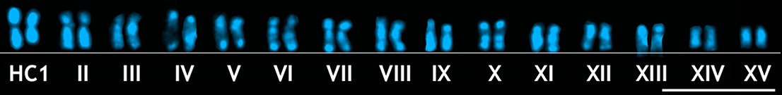 Pistachio tree: Karyotype of Pistachio (Pistacia vera) stained with DAPI. 2n = 30. Bar represents 2.5 μm.
