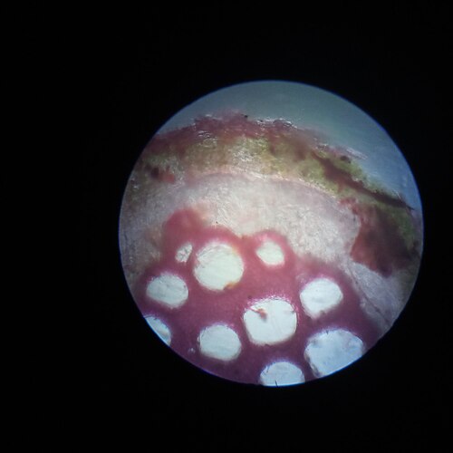 Amrita: It is a cross-sectional compound microscopic view of normal secondary growth of dicot root. Stain used is: Safranin