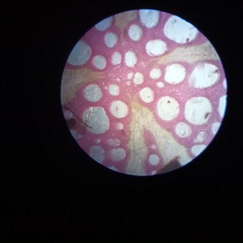 Amrita: It is a cross-sectional compound microscopic view of normal secondary growth of dicot root. Stain used is: Safranin