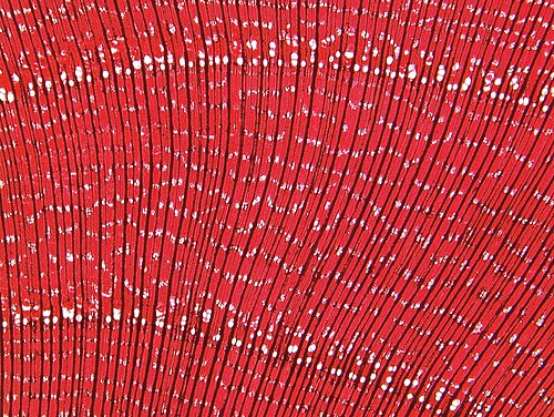 Wych elm: Thin section of wood from Wych Elm, Ulmus glabra. Stained microscope slide showing the vascular structure of wood. Microscope sections are taken of wood to aid