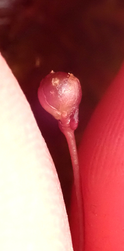 Utricularia delicatula (Utricularia delicatula)