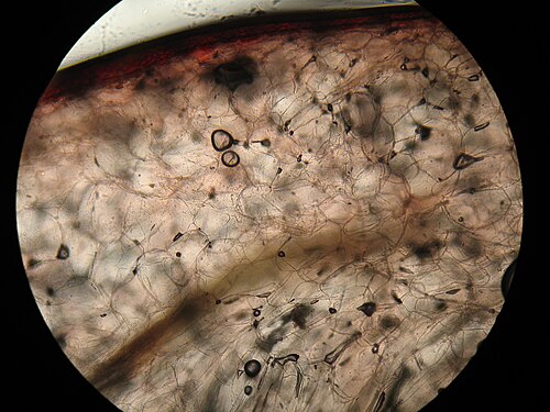 Small cranberry: A cross-section of a Vaccinium oxycoccos under a microscrope (total magnification 200X).